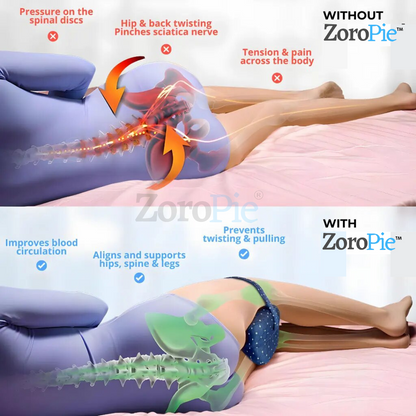 Zoropie™️Alignment Pillow - Relieve Hip Pain & Sciatica