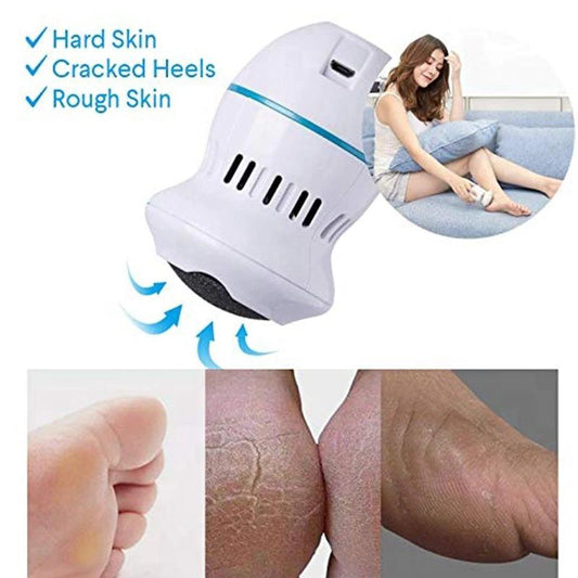 PORTABLE ELECTRIC CALLUS AND DEAD SKIN REMOVER - FlipinFit